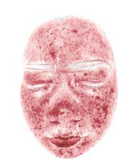 Rosto feminino no mapa de hemoglobina, em rosa, com as áreas de maior concentração mais escuras